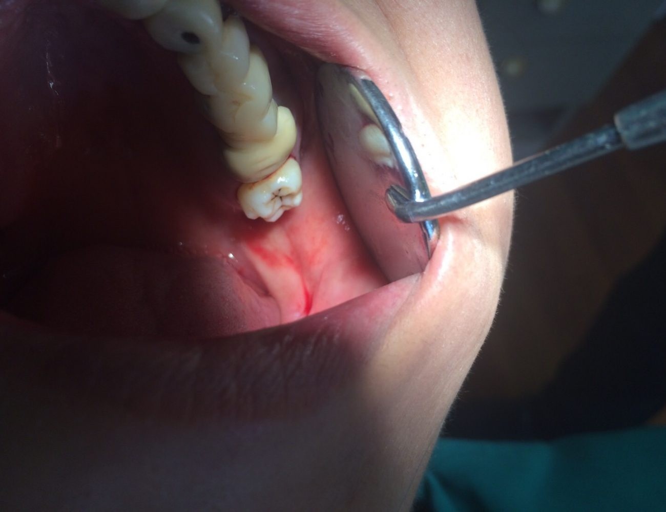 患者様の大切な歯を最大限に活かす治療を大切にしています。