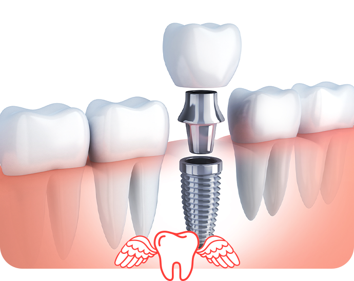 天然歯のような噛み心地を再現