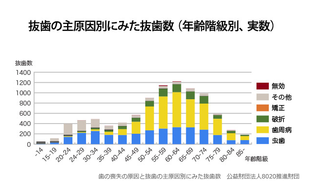 初期段階では自覚症状がほとんどなく、気づかないうちに悪化することが多いため、予防歯科の観点からも定期的なクリーニングが重要です