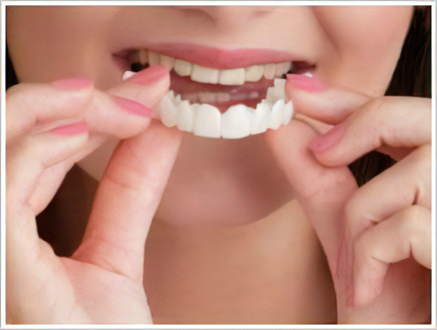 着脱できるスナップオンスマイル