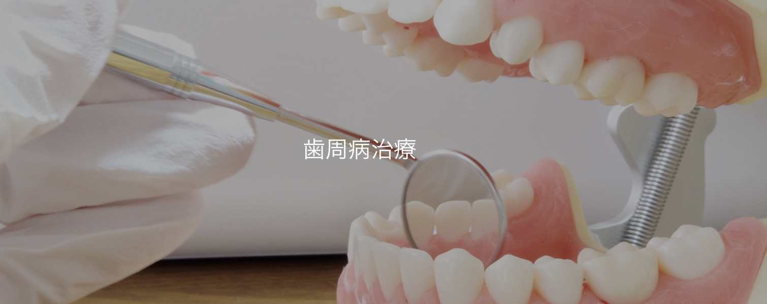 歯周ポケットの状態を細かく確認し、一人ひとりの状態に合わせた治療を行っています