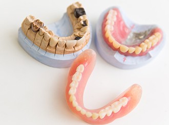 患者様のお口の状態や使用中の悩み、見た目の希望を確認し、日々の食事や会話を快適に楽しめる入れ歯を提案しています。