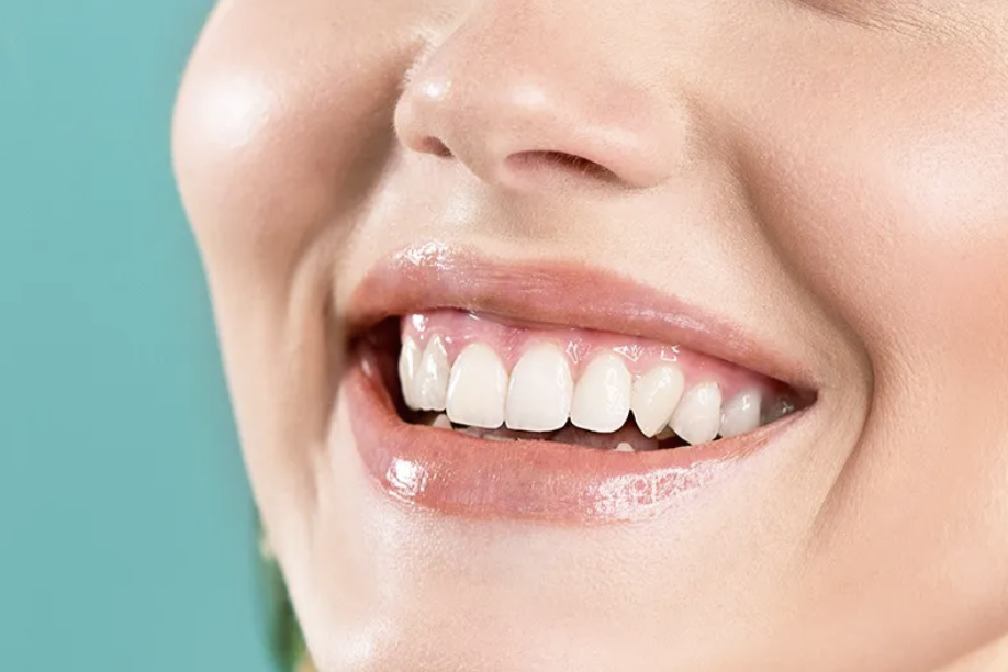 歯の黄ばみやくすみが気になる方に向けて、ホワイトニングを提供しています