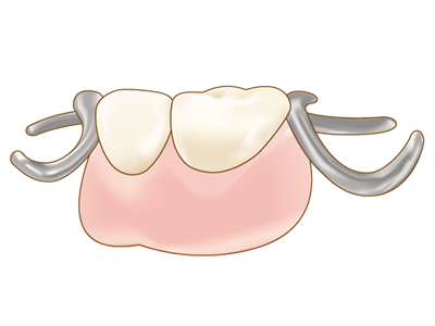 しっかり噛める、自然に見える入れ歯づくりをサポート