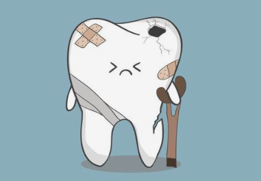 虫歯の原因はいくつかあります