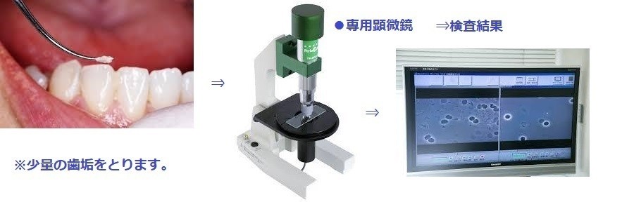 細菌検査を実施します