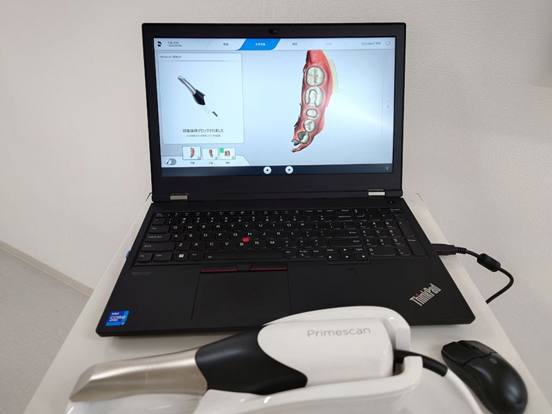 口腔内スキャナー完備