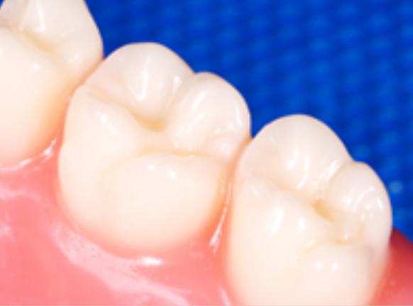 健康で美しい笑顔を守りましょう。