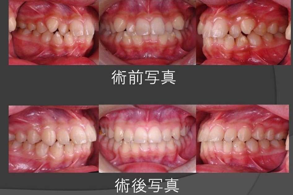 丁寧な矯正治療で、将来まで見据えた口元の健康をサポート