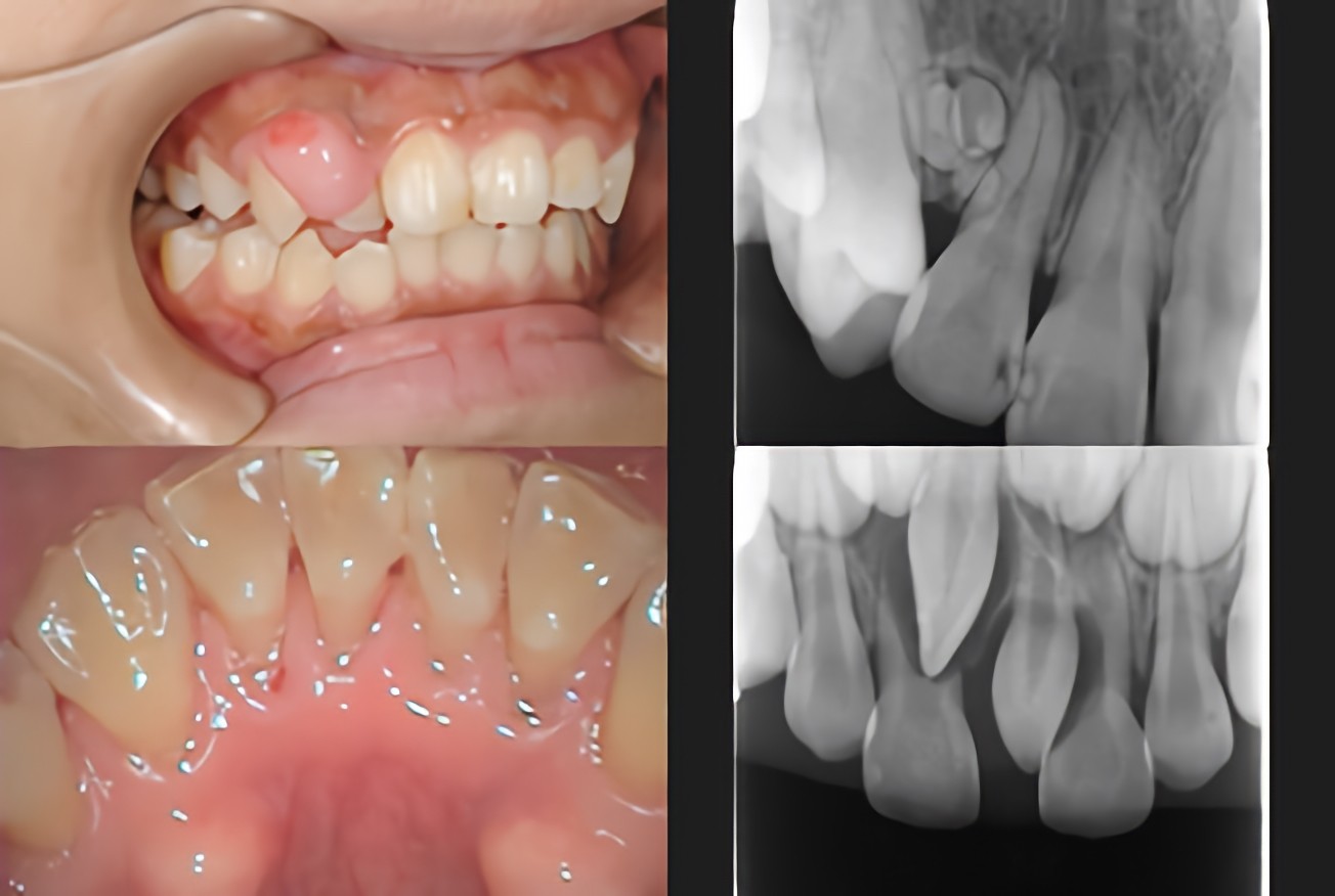 早めの受診をおすすめします