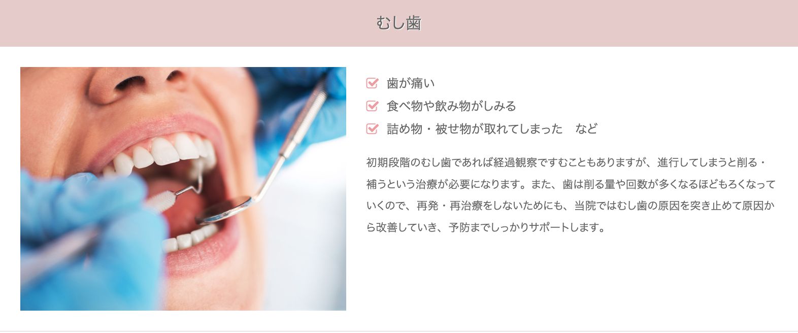 むし歯や歯の痛みといったトラブルに対し、できる限り歯を残す治療を大切にしています