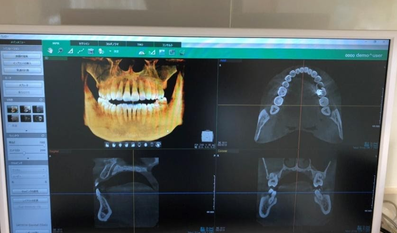 医療ではなく、“暮らし”を支える覚悟