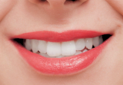 オフィスとホームの選択肢で個々のニーズに応える美白治療