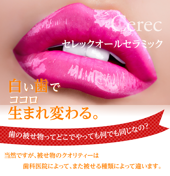 セレックシステムにより患者様の時間的負担を大幅に軽減することができます