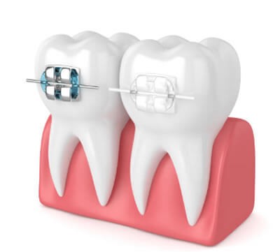 最適な治療法をご提案します