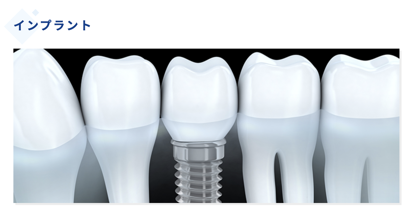 患者様の希望やお口の状態に応じた治療計画を提案いたします
