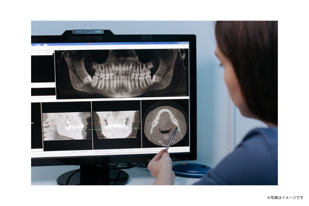 【中川原駅 徒歩12分】丁寧なケアで歯周病管理と再発予防に取り組み、安心なキッズルームを備えるあだち歯科クリニック