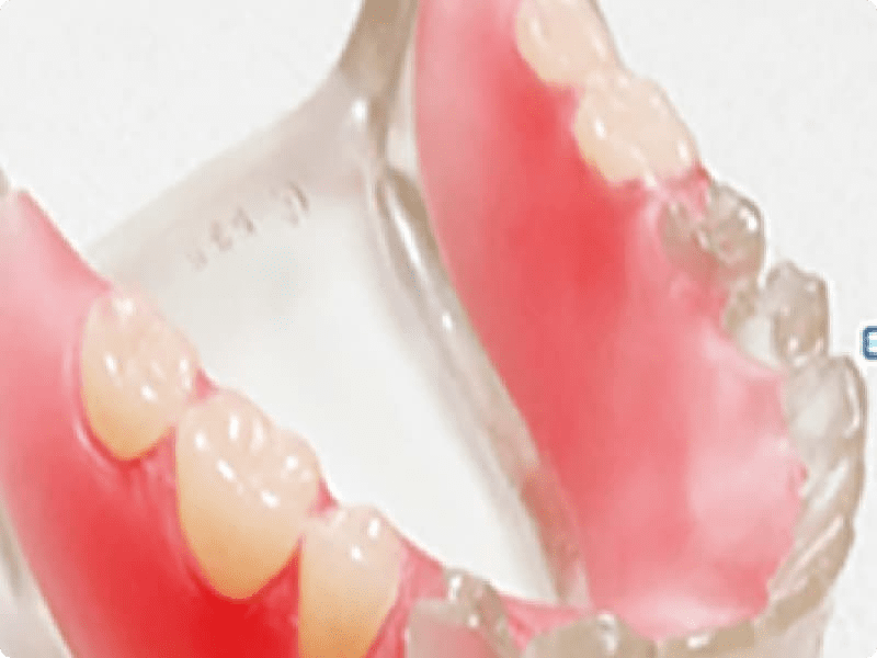 歯を失ったことでお困りの患者様に対し、お口の機能回復を目的とした治療を行っています