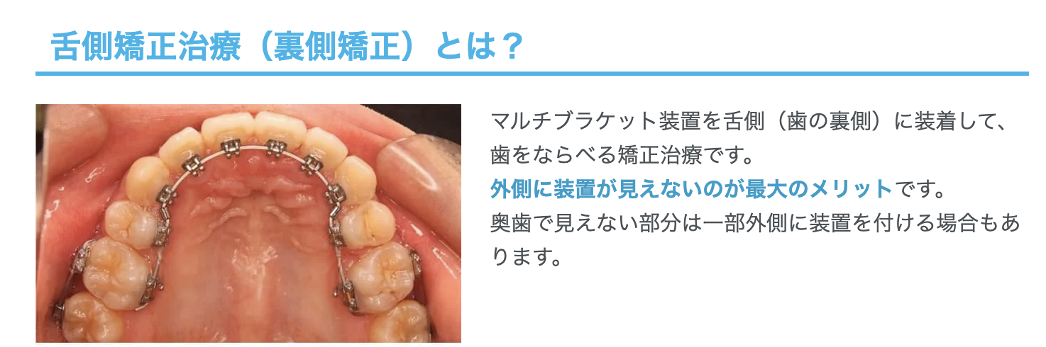 舌側矯正治療（裏側矯正）を提供し、矯正装置が目立たない快適な治療を実現しています