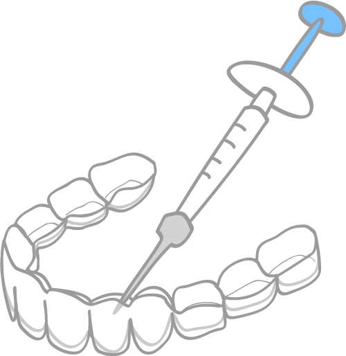 ホームホワイトニング