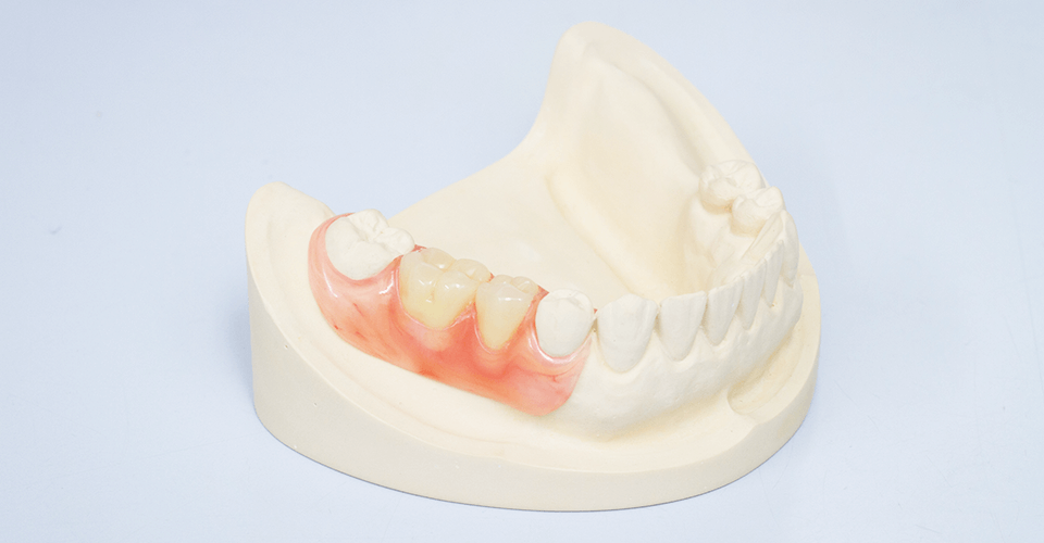 カウンセリングを重視し快適な入れ歯を提案します