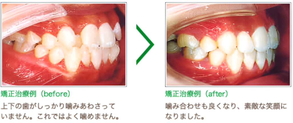 患者様一人ひとりに寄り添った矯正治療
