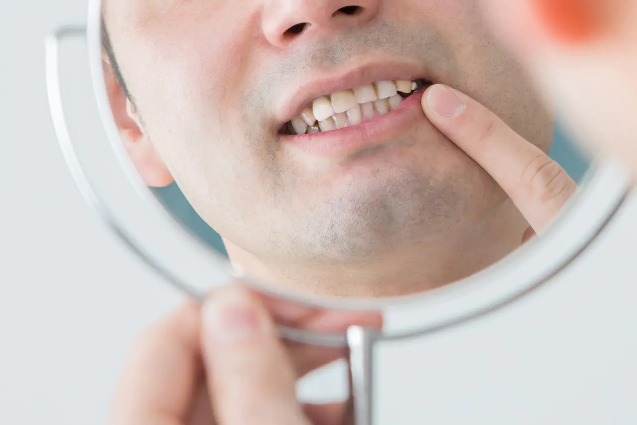 歯を削る量や治療の侵襲を最小限に抑える工夫が随所に取り入れられています