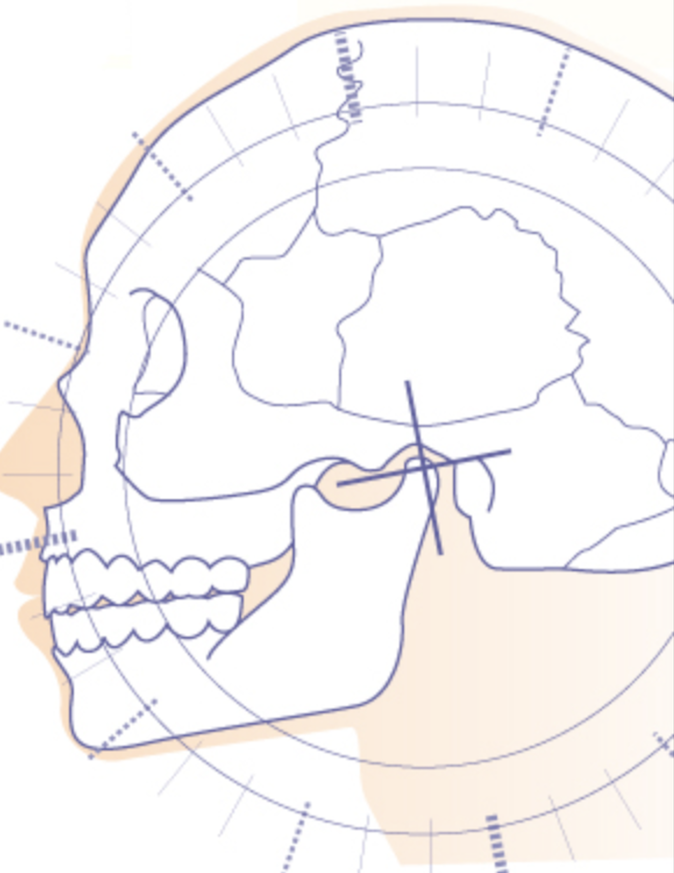 矯正歯科のイメージ