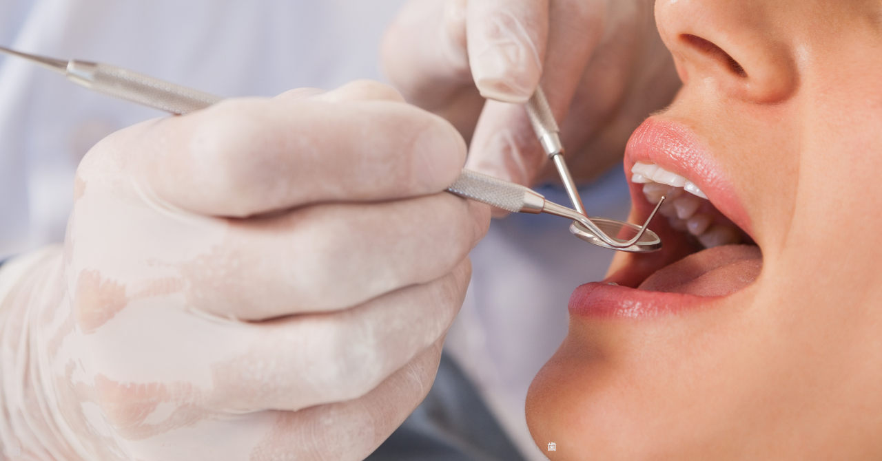 虫歯は早期発見・早期治療がカギ