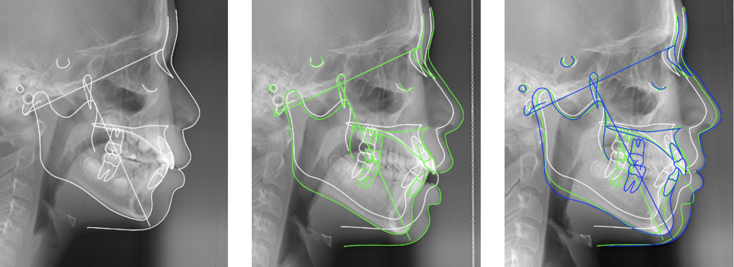 顔立ちの調和と機能的な咬み合わせの獲得を目標