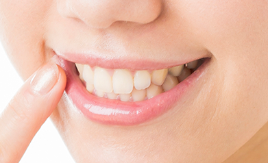 口元に自信がもてると、毎日がもっと明るくなる