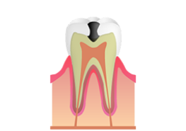 歯に違和感や痛みを感じた際は、放置せずに早めにご相談ください。