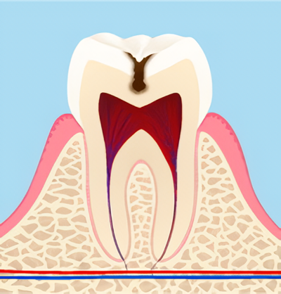 「痛くない」「不安のない」やさしい治療