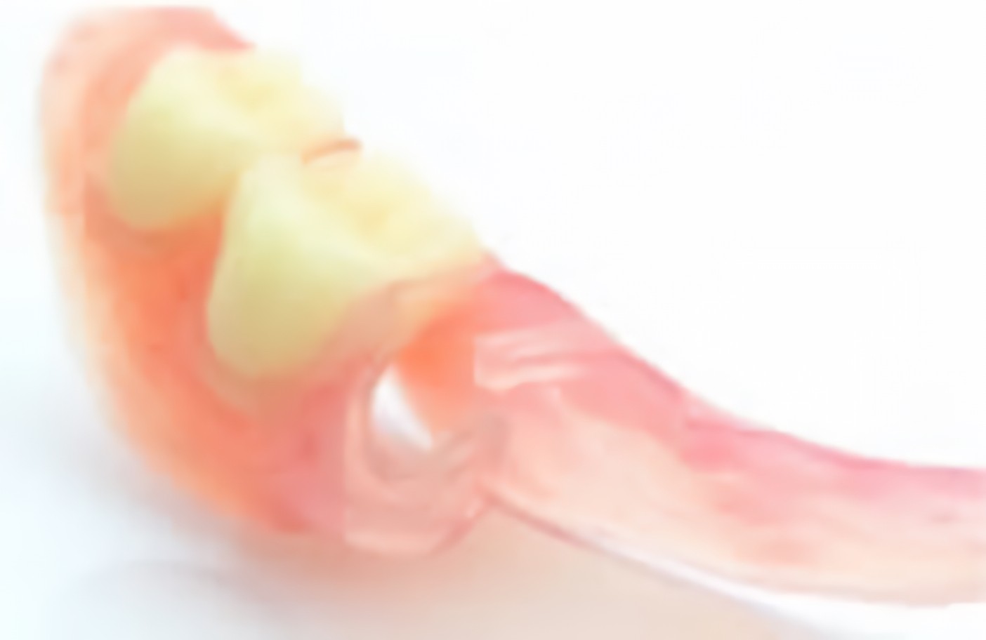 ノンクラスプデンチャー