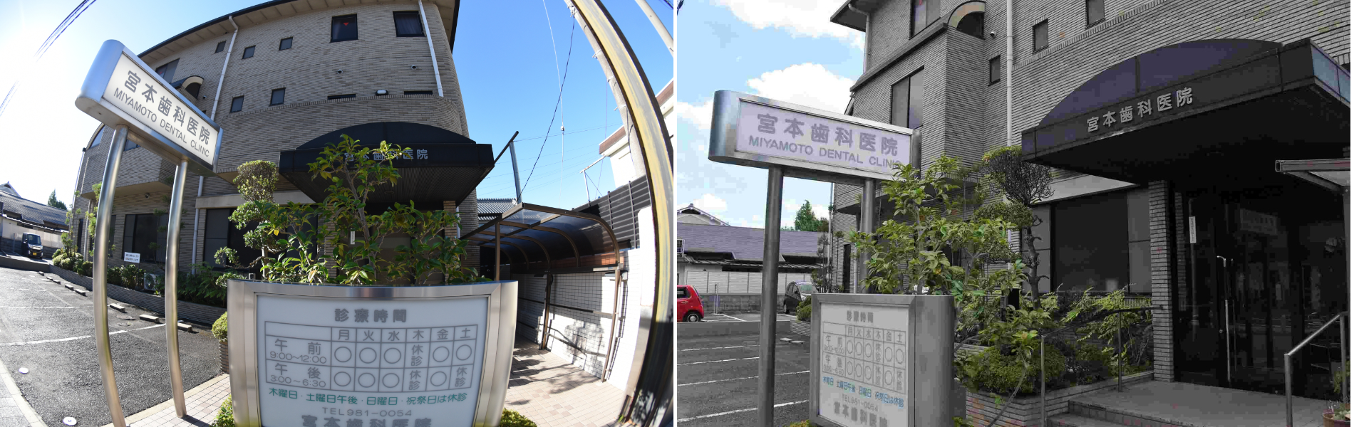 ①外観②CT③清掃器具