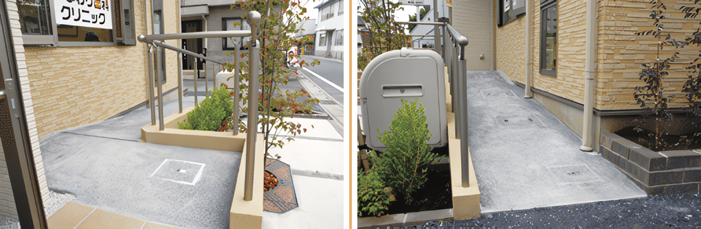 歯ブラシでは除去できない歯石を取り除きます