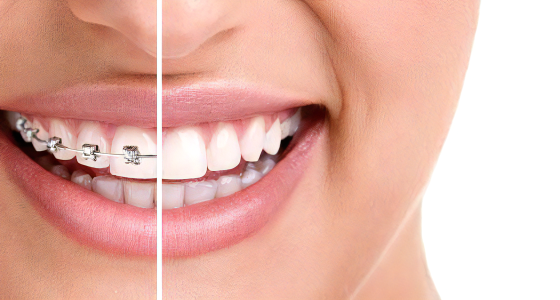 矯正歯科治療を提供