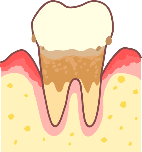 歯周病の再発防止と健康維持を全力サポート