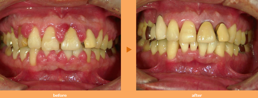 適切な治療で改善できます