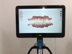 口腔内スキャナーで歯並びを撮影します