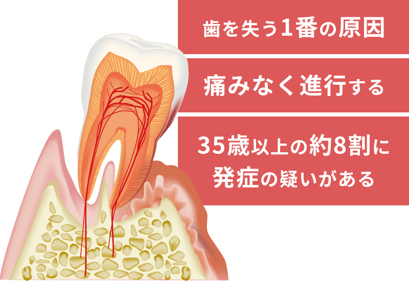 歯周病の早期発見・早期治療に取り組み、できる限り歯を残すことを目指した治療が行われています