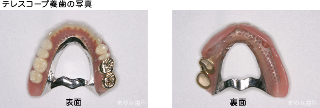 快適な入れ歯を提案いたします