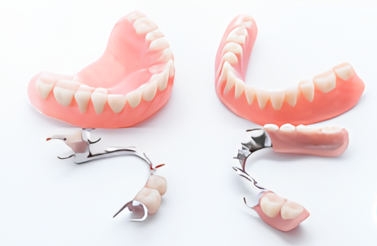 機能性と審美性を兼ね備えた入れ歯