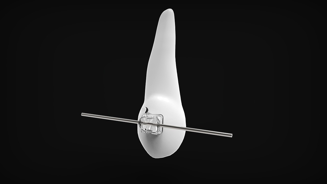 将来の健康を見据えた矯正治療を通じて、お子様の健やかな成長を支えていきます。※写真はイメージです。