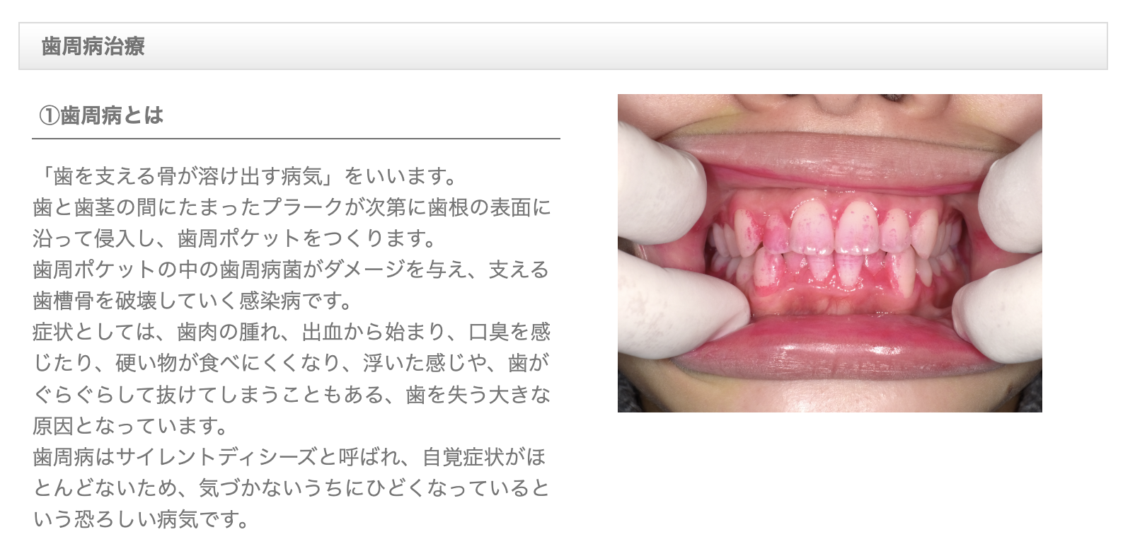 口腔ケアを徹底することは健康維持にもつながります