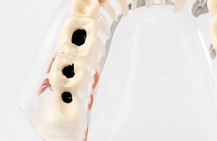 見た目と健康の両立をめざすオーダーメイド矯正