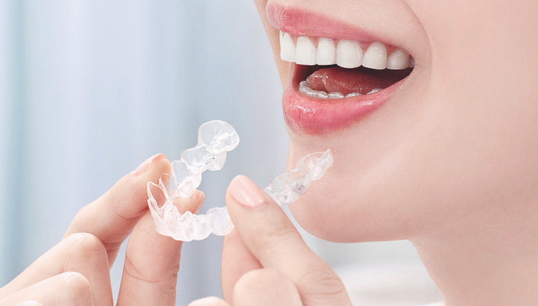 インビザラインを取り扱っています