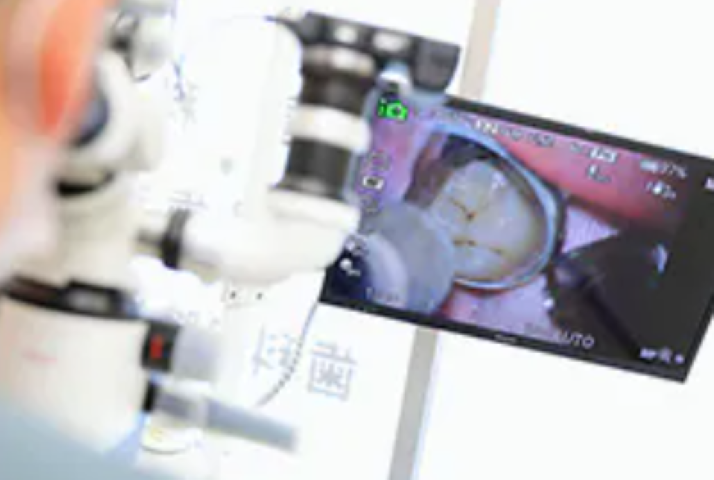 再発を防ぐ精密な根管治療で患者様の歯を守る