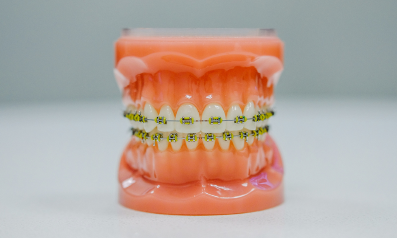 お子様から大人の方まで対応する自然な矯正治療