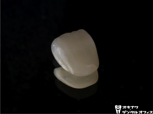 オールセラミックの持つ自然な透明感